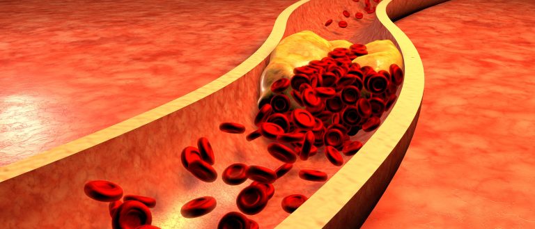 why cardiac pet ct imaging